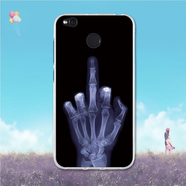 Case For Xiaomi Redmi 4X Cover 3D Cute Bags Soft Silicone TPU Cover For Xiaomi Redmi 4X Case For Redmi 4X Redmi4x Phone Cases